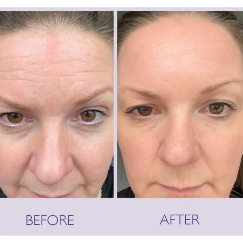 CELIMAX RETINAL SHOT TIGHTENING BOOSTER 15ML