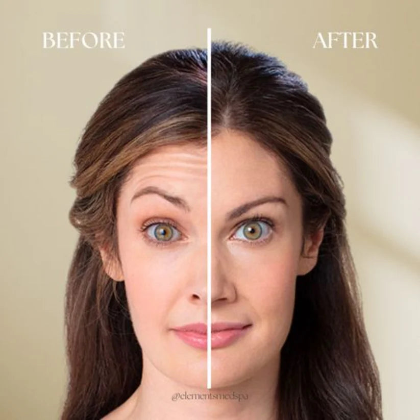 CELIMAX RETINAL SHOT TIGHTENING BOOSTER 15ML