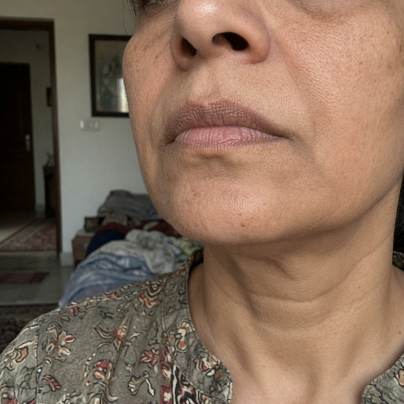Before - 