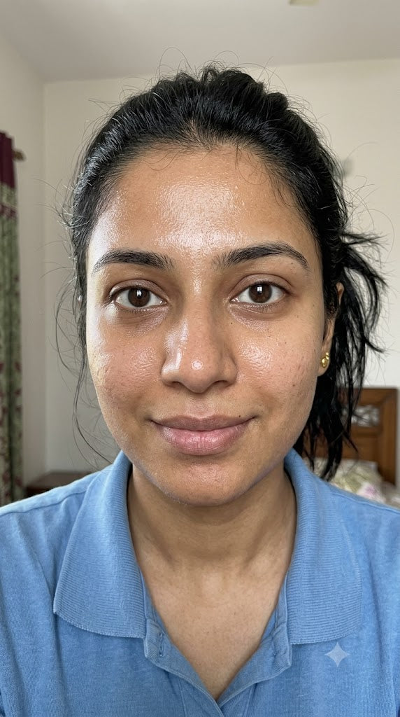 You have enlarged pores that show in every selfie