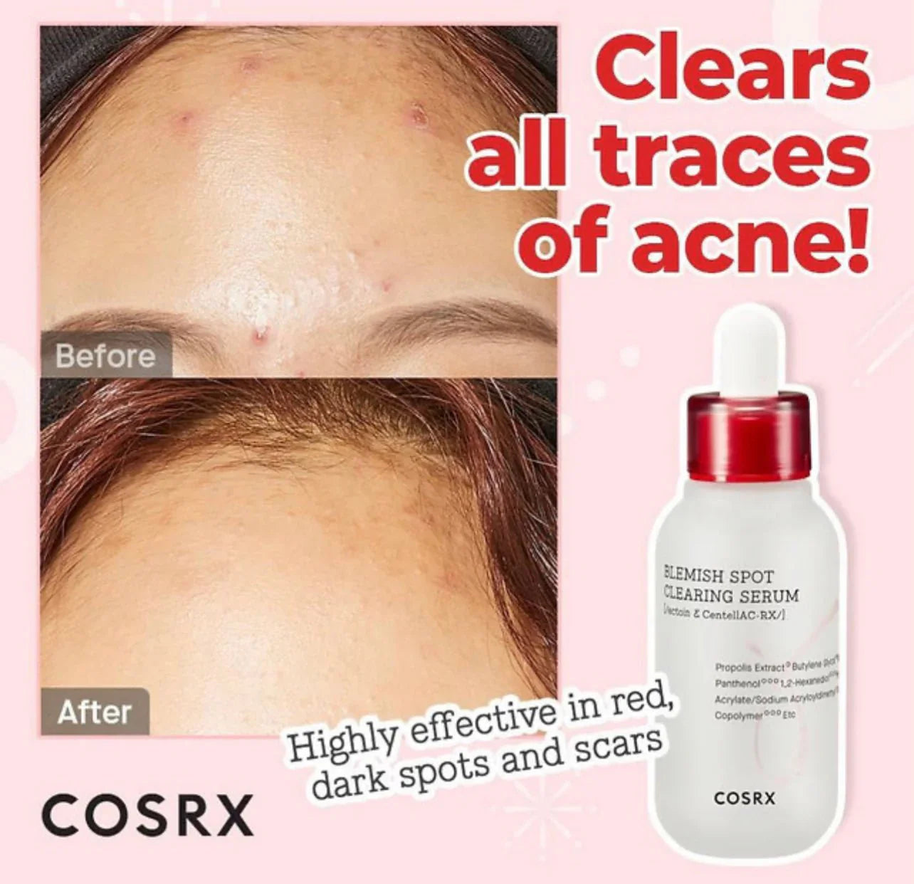 Blemish Spot Clearing Serum 40ml